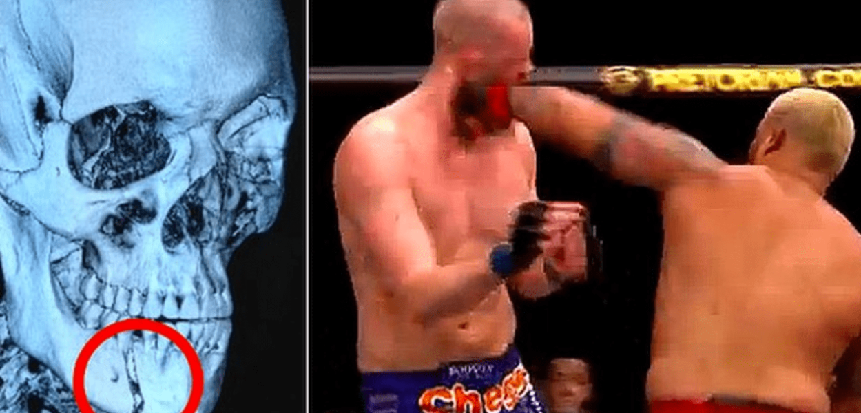 Le légendaire KO de Mark Hunt sur Stefan Struve