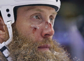 Joe Thornton a joué avec deux ligaments déchirés