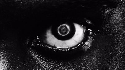 Damso Lithopedion