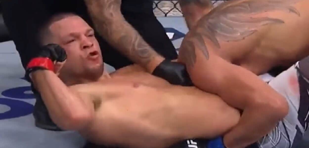 Diaz-Ferguson