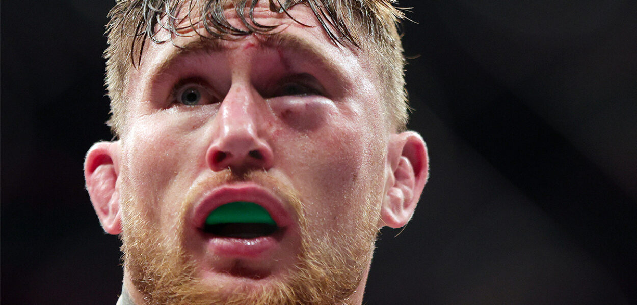 darren till rupture ufc