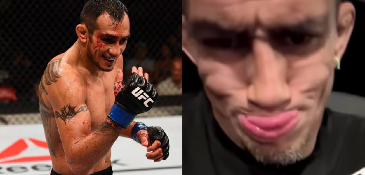 tony ferguson malade